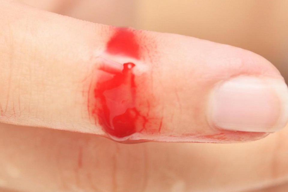 cut-on-finger-with-blood